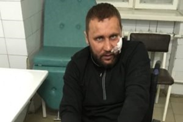 З чого почалася бійка, яка закінчилася відомо чим
