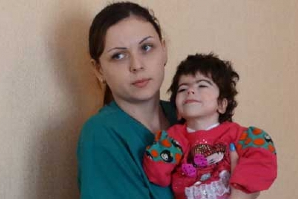 Тернопільська сім’я взяла на виховання маленьку сумчанку-інваліда (Фото)