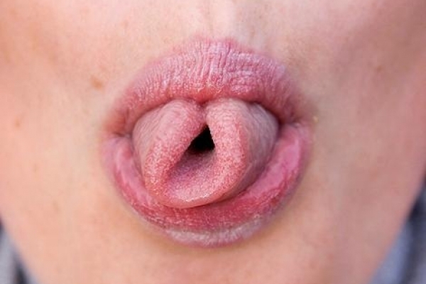 Тернополянам нагадують, що не варто лизати все підряд