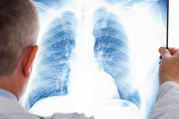 Тернопільським медикам пропонують відійти від радянських методів